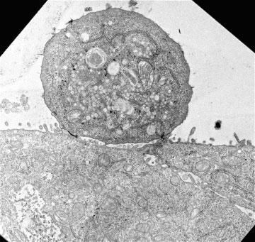 รูปแบบของการรักษา calciticosis