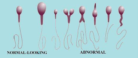 ที่จะผ่านการวิเคราะห์เกี่ยวกับ spermogrammu