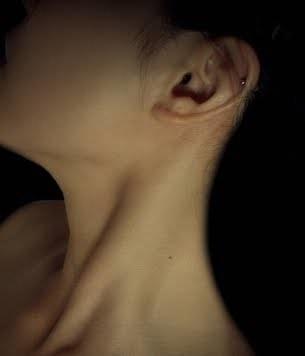 sternocleidomastoid mastoid กล้ามเนื้ออักเสบ