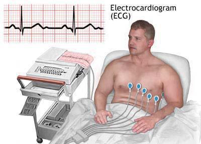 วิธีการทำ ECG กับเด็ก ECGs สำหรับผู้หญิง?