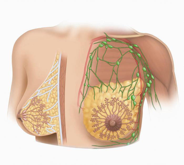 Bartholin รักษาถุงต่อมหมวกไตของการเยียวยาพื้นบ้าน 